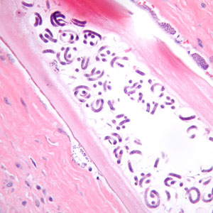 Case384_C.jpg