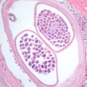 Case384_D.jpg