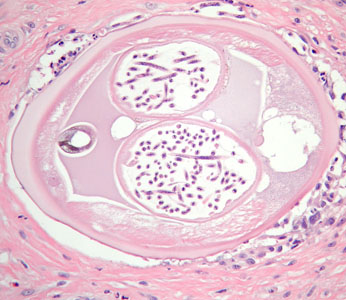Case384_E.jpg