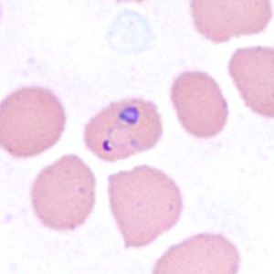 Case385_A.jpg