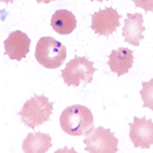 Case385_E.jpg