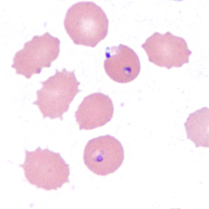 Case385_F.jpg