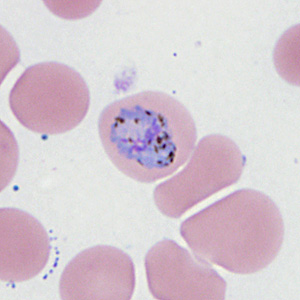 Case410_D.jpg