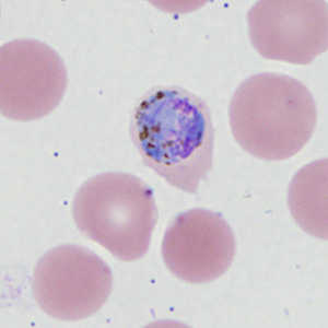 Case410_I.jpg