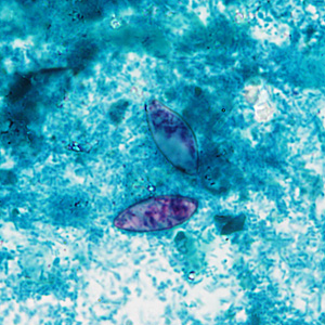 Case430_A.jpg