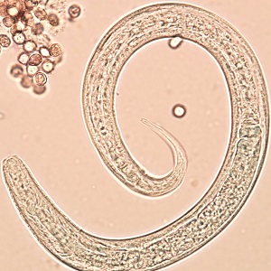 Figure C