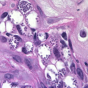 Leish_amasti_HnE_tissue_mn.jpg