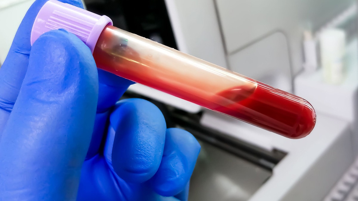 Gloved hand holding a vial of blood