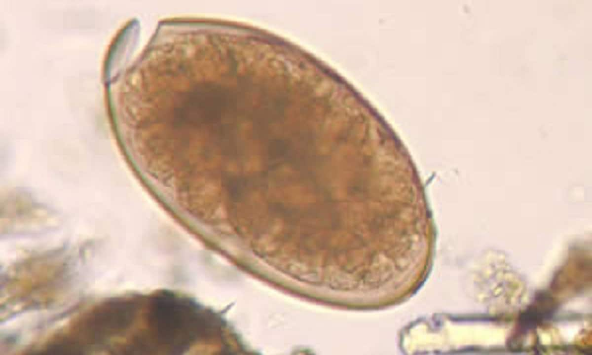 fasciola egg