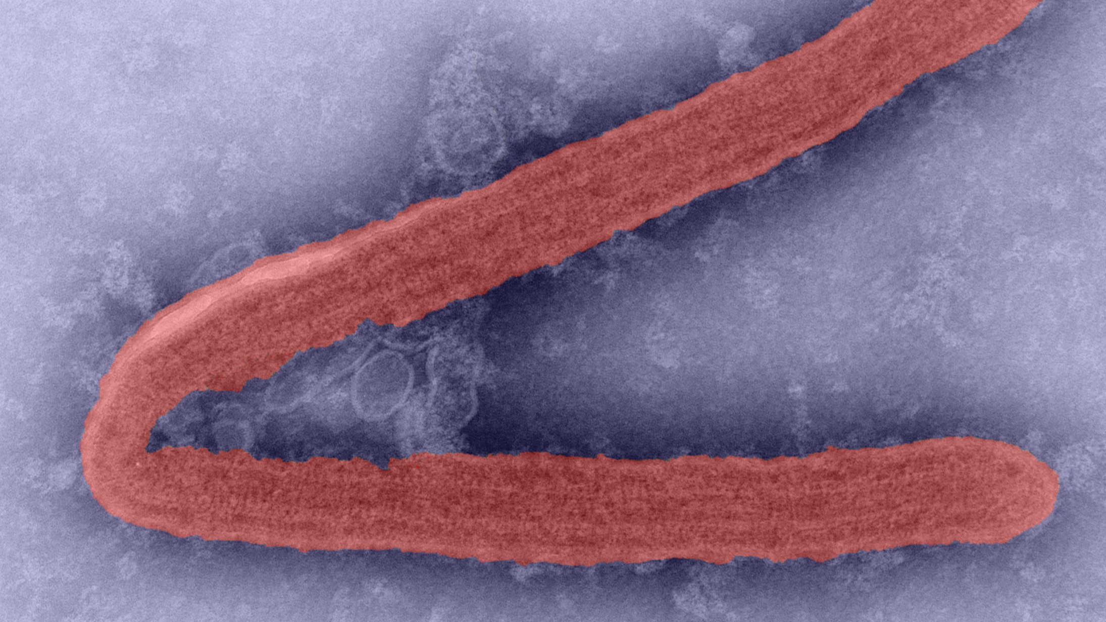 A microscopic image of the Marburg virus