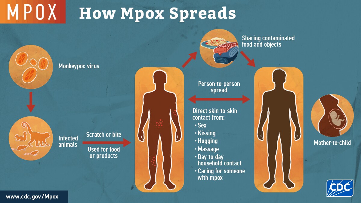 Mpox spreads from animals to people via scratches, bites, or as food, then people spread it to other people by close contact