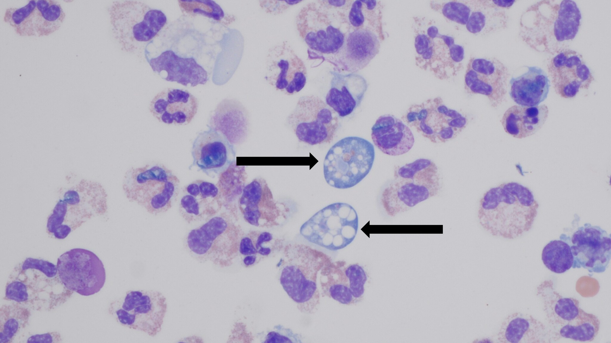 High resolution ofNaegleria fowleri ameba.