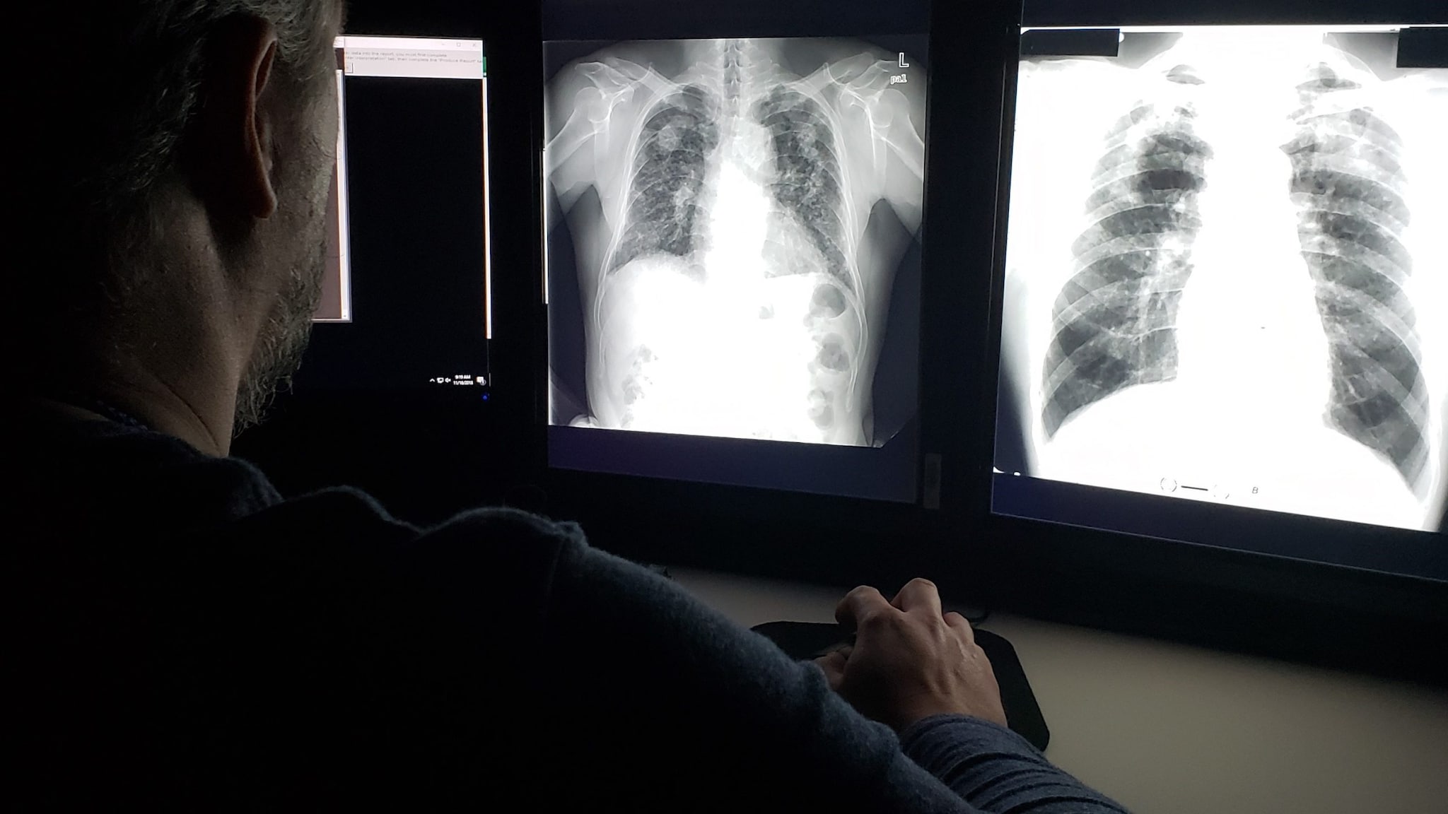 A B Reader examining check x-rays.