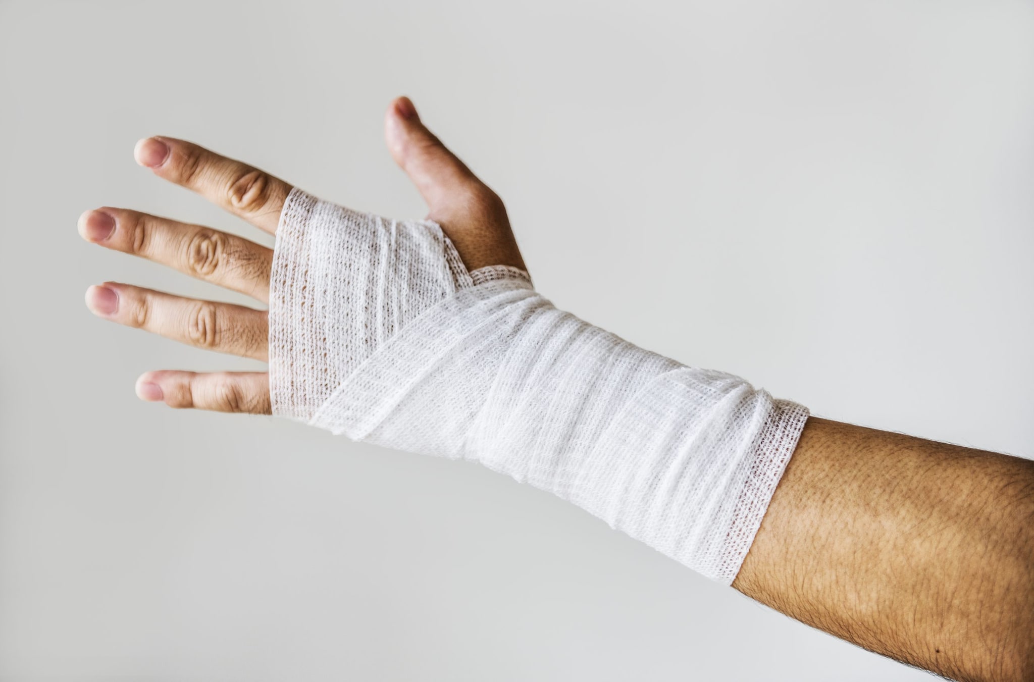 A photo of a sprain wrist wrapped in a bandage.