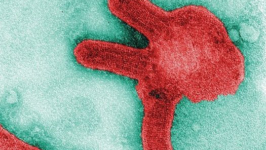 marburg virus Microscopic image of Marburg Virus