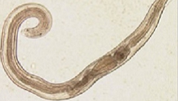 Enterobius vermicularis pinworm