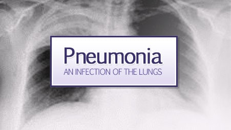 x-ray of the lungs with pneumonia