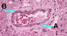 Microscope image of blood vessel without inflammatory cells