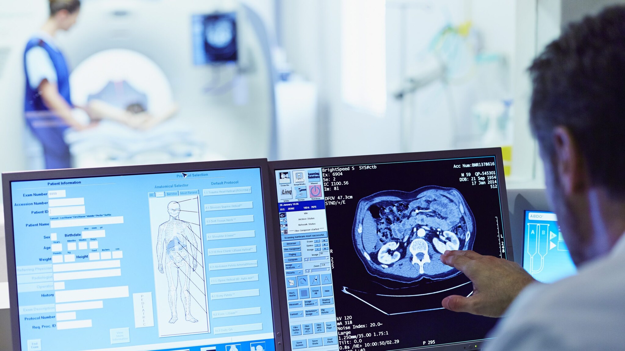 A doctor points at a brain scan on computer screen