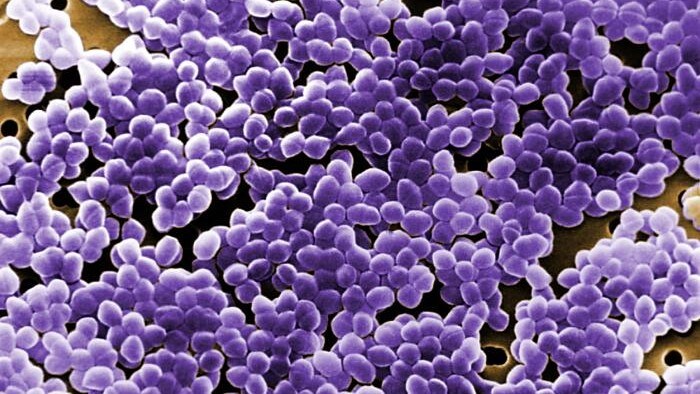 This digitally colorized scanning electron microscopic image depicted large numbers of Gram-positive, Enterococcus sp. bacteria.