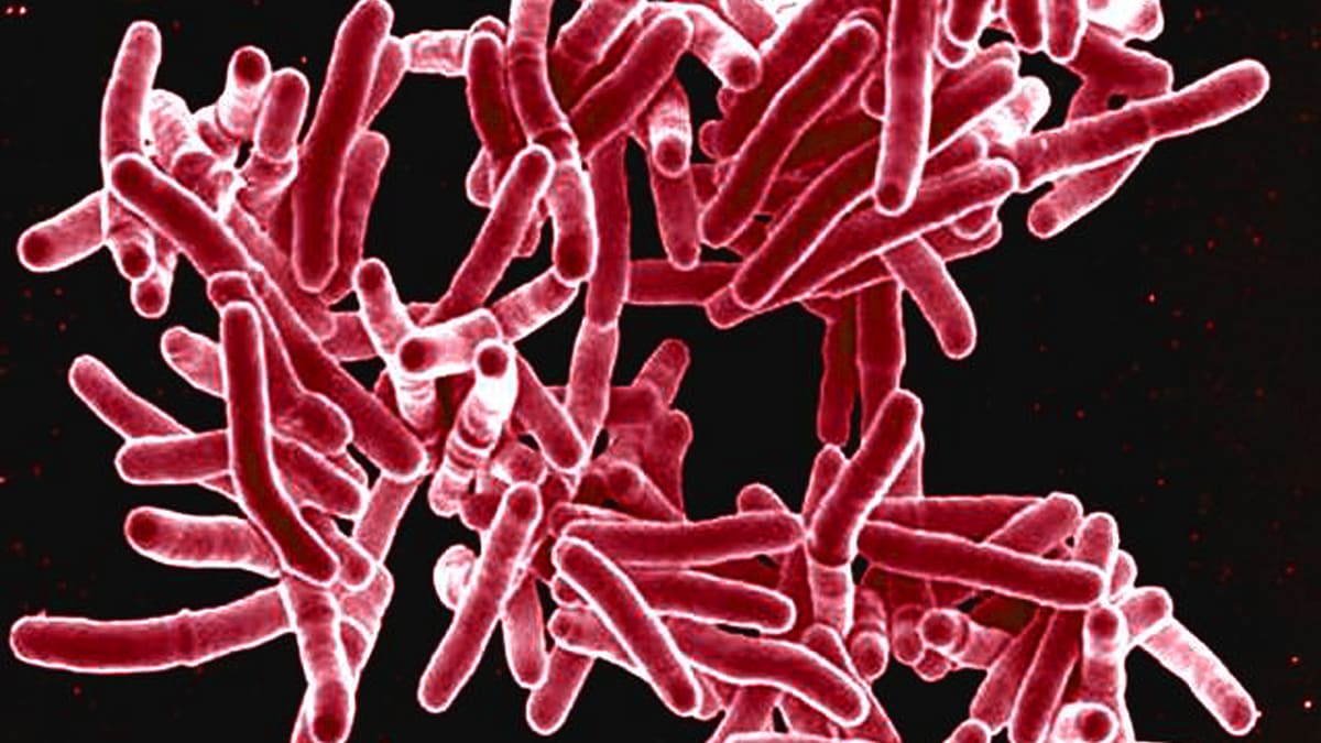 Tuberculosis bacteria