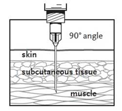 Administering Vaccines: Dose, Route, Site and Needle Size.