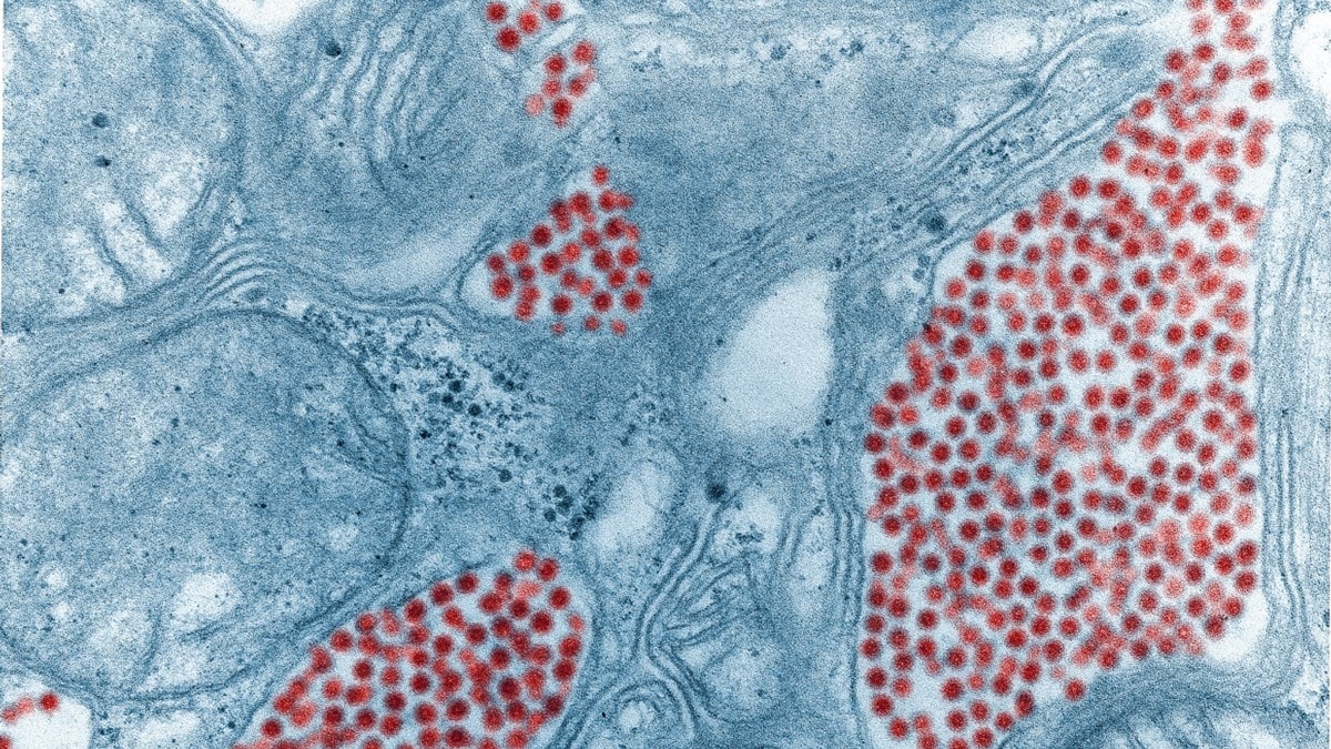 Eastern equine encephalitis virus in mosquito salivary gland tissue.