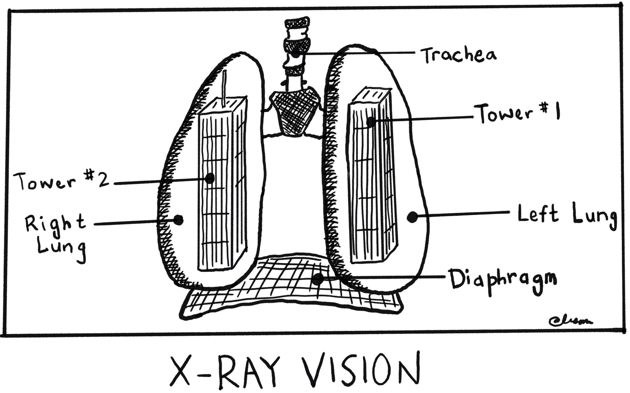 Cartoon reproduction of lungs created and provided by Ali Shapiro,
								former Stuyvesant High School Student.